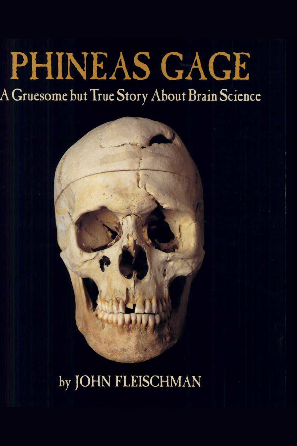 Phineas Gage: A Gruesome But True Story about Brain Science